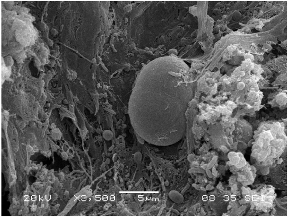 Tapete microbiano, laguna rosada, micrografia electronica de barrido