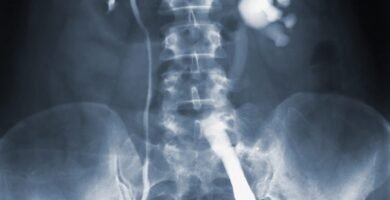 an x - ray of a man's back and neck